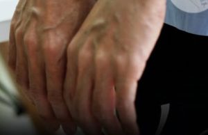 7 Daily Habits That Make Your Veins Bulge More