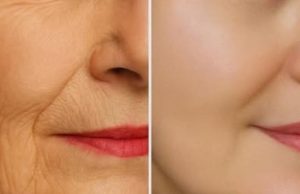 My aunt taught me how to prepare my own homemade cream to remove wrinkles and blackheads.